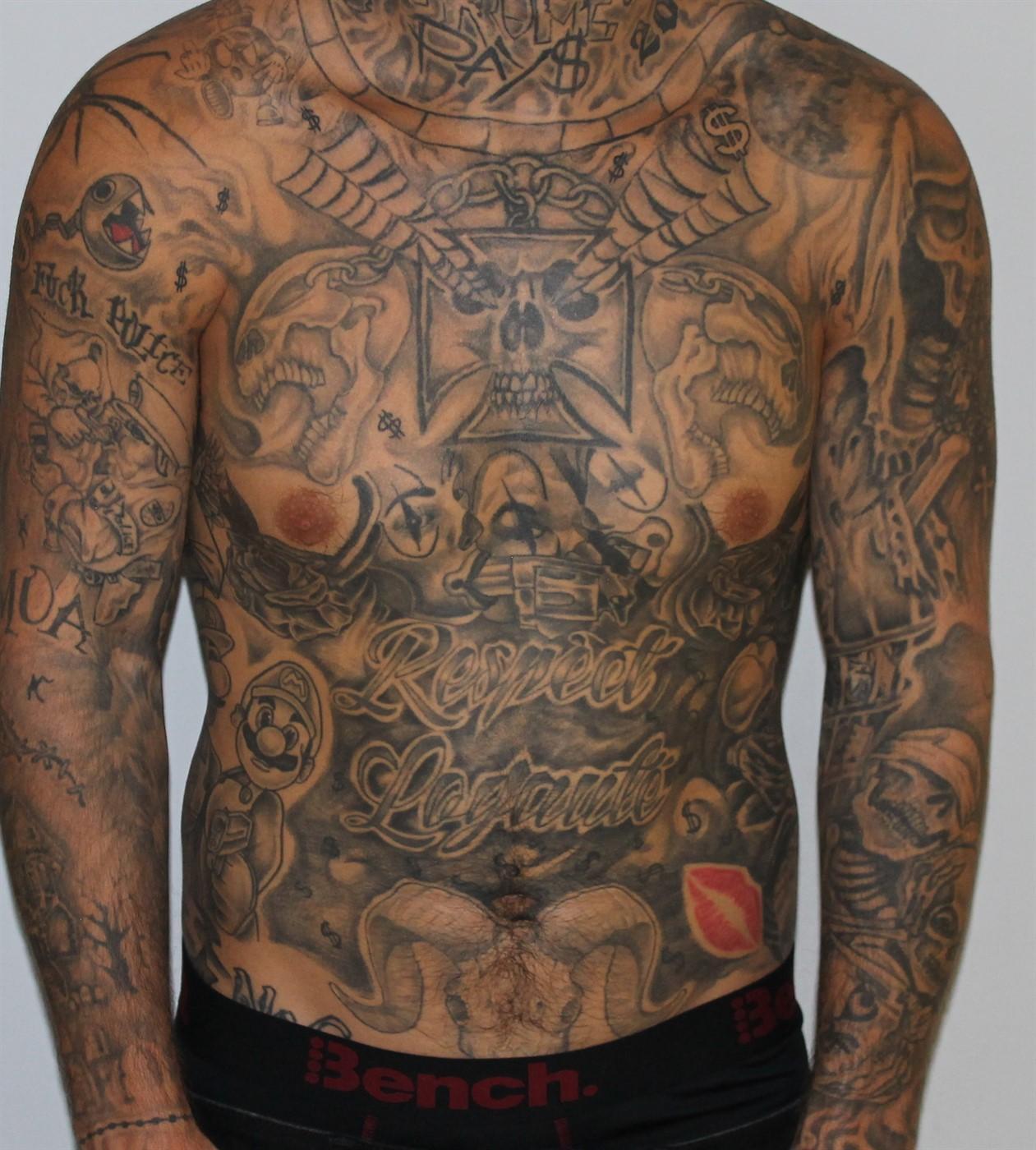 Abdomen